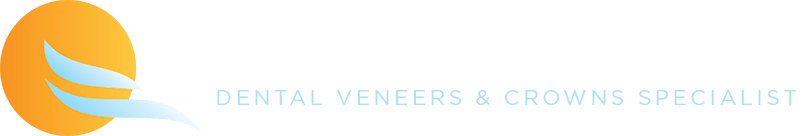 Veneers San Diego | Best Dental Veneers